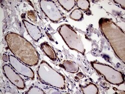 RRBP1 Monoclonal Antibody (OTI3F1), TrueMAB , OriGene 100 &mu;L; Unconjugated:Antibodies,