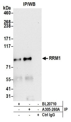 RRM1 Rabbit anti-Human, Mouse, Polyclonal, Bethyl Laboratories 100 &mu;L;