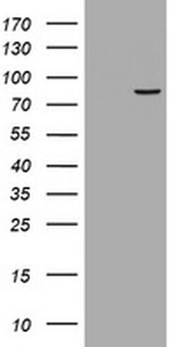 RRM1 Monoclonal Antibody (OTI13E4), TrueMAB , OriGene:Antibodies:Primary