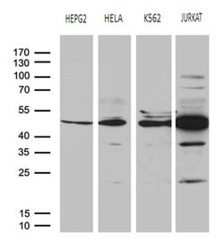 RRM2 Mouse anti-Human, Clone: OTI3D3, liquid, TrueMAB 100 &mu;L; Unconjugated:Antibodies,