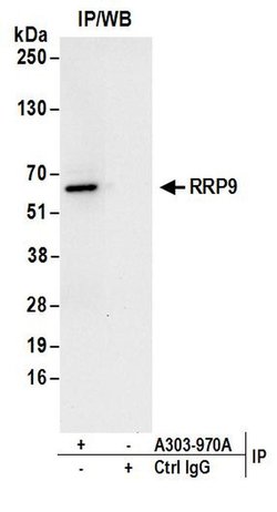 RRP9 Rabbit anti-Human, Polyclonal, Bethyl Laboratories 100 &mu;L; Unconjugated:Antibodies,