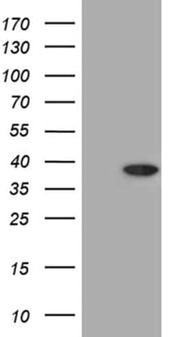 RSG1 Monoclonal Antibody (OTI4H7), TrueMAB , OriGene 100 &mu;L | Buy Online | OriGene | Fisher Scientific