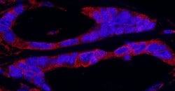 RSK1 Rabbit anti-Human, Polyclonal, Bethyl Laboratories 100 &mu;l; Unlabeled:Antibodies,