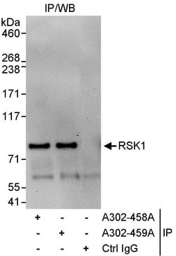 RSK1 Rabbit anti-Human, Polyclonal, Bethyl Laboratories 100 &mu;l; Unlabeled:Antibodies,