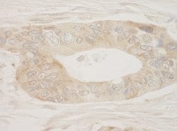 RSK2 Polyclonal Antibody, Bethyl Laboratories 100 &mu;L; Unconjugated:Antibodies,