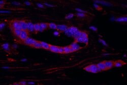 RSK2 Polyclonal Antibody, Bethyl Laboratories 100 &mu;L; Unconjugated:Antibodies,
