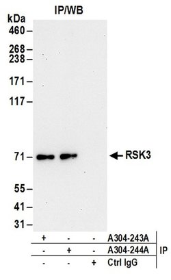 RSK3 Rabbit anti-Human, Polyclonal, Bethyl Laboratories 100 &mu;l; Unlabeled:Antibodies,