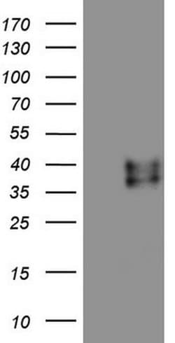 RSPO3 Monoclonal Antibody (OTI3A9), TrueMAB , OriGene 100 &mu;L; Unconjugated:Antibodies,