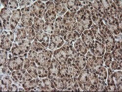 RTKN Mouse anti-Human, Clone: OTI2E9, lyophilized, TrueMAB 100 &mu;g; Unconjugated:Antibodies,