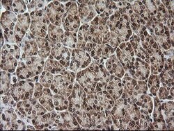 RTKN Monoclonal Antibody (OTI2E9), TrueMAB , OriGene 100 &mu;L; Unconjugated:Antibodies,