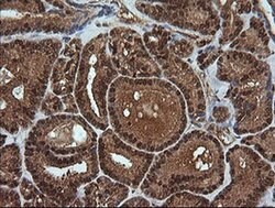 RTKN Monoclonal Antibody (OTI2E9), TrueMAB , OriGene 100 &mu;L; Unconjugated:Antibodies,
