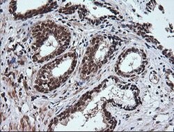 RTKN Monoclonal Antibody (OTI2E9), TrueMAB , OriGene 100 &mu;L; Unconjugated:Antibodies,