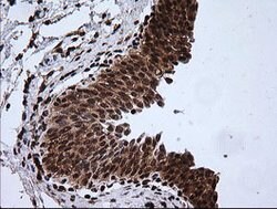 RTKN Mouse anti-Human, Clone: OTI2E9, lyophilized, TrueMAB 100 &mu;g; Unconjugated:Antibodies,