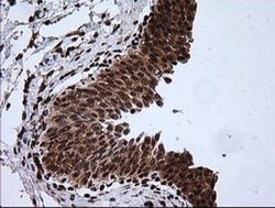 RTKN Monoclonal Antibody (OTI2E9), TrueMAB , OriGene 100 &mu;L; Unconjugated:Antibodies,