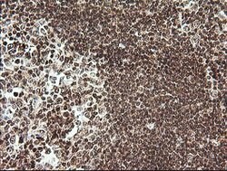 RTKN Mouse anti-Human, Clone: OTI2E9, lyophilized, TrueMAB 100 &mu;g; Unconjugated:Antibodies,