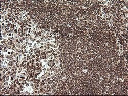 RTKN Monoclonal Antibody (OTI2E9), TrueMAB , OriGene 100 &mu;L; Unconjugated:Antibodies,