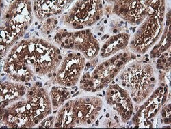 RTKN Mouse anti-Human, Clone: OTI2E9, lyophilized, TrueMAB 100 &mu;g; Unconjugated:Antibodies,