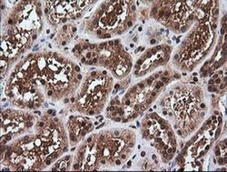 RTKN Monoclonal Antibody (OTI2E9), TrueMAB , OriGene 100 &mu;L; Unconjugated:Antibodies,