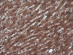 RTKN Mouse anti-Human, Clone: OTI2E9, lyophilized, TrueMAB 100 &mu;g; Unconjugated:Antibodies,