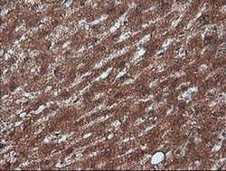RTKN Monoclonal Antibody (OTI2E9), TrueMAB , OriGene 100 &mu;L; Unconjugated:Antibodies,