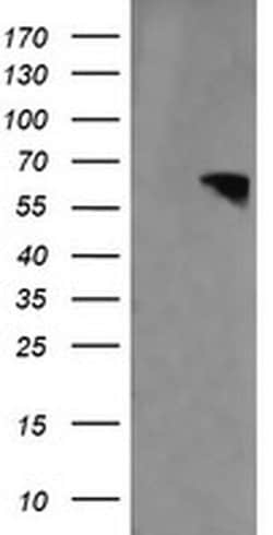 RTKN Monoclonal Antibody (OTI2E9), TrueMAB , OriGene 100 &mu;L; Unconjugated:Antibodies,