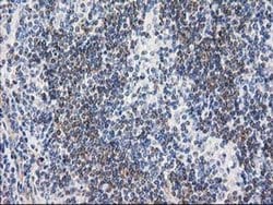 RTN4IP1 Monoclonal Antibody (OTI3B2), TrueMAB , OriGene 30 &mu;L; Unconjugated:Antibodies,