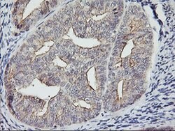 RTN4IP1 Monoclonal Antibody (OTI1A8), TrueMAB , OriGene:Antibodies:Primary