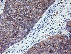RTN4IP1 Monoclonal Antibody (OTI1A8), TrueMAB , OriGene 30 &mu;L; Unconjugated:Antibodies,