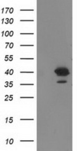 RTN4IP1 Mouse anti-Human, Clone: OTI1B2, lyophilized, TrueMAB 100 &mu;g;
