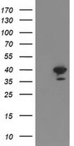 RTN4IP1 Monoclonal Antibody (OTI1E1), TrueMAB , OriGene 100 &mu;L; Unconjugated:Antibodies,