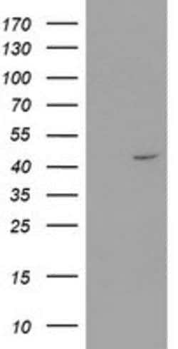 RTN4IP1 Mouse anti-Human, Clone: OTI1A8, lyophilized, TrueMAB 100 &mu;g;