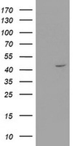 RTN4IP1 Monoclonal Antibody (OTI1A8), TrueMAB , OriGene 30 &mu;L; Unconjugated:Antibodies,