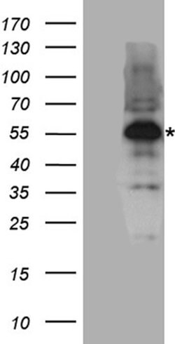 RUNX1 Rabbit anti-Human, Mouse, Polyclonal, liquid, OriGene 100 &mu;L;