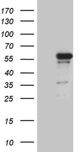 RUNX3 Monoclonal Antibody (OTI11D5), TrueMAB , OriGene 100 &mu;L; Unconjugated:Antibodies,