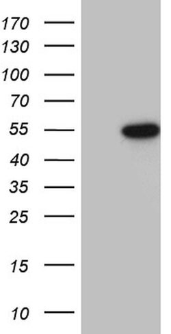 RUNX3 Mouse anti-Human, Clone: OTI12F2, lyophilized, TrueMAB 100 &mu;g;