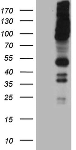 RUSC2 Monoclonal Antibody (OTI1A1), TrueMAB , OriGene 100 &mu;L; Unconjugated:Antibodies,