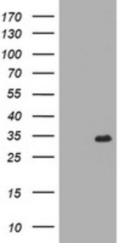 RYBP Mouse anti-Human, Clone: OTI7D1, lyophilized, TrueMAB 100 &mu;g; Unconjugated:Antibodies,