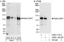 Rab3-GAP1 Rabbit anti-Human, Polyclonal, Bethyl Laboratories 100 &mu;L;