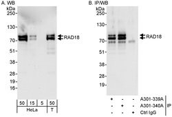 Rad18 Rabbit anti-Human, Polyclonal, Bethyl Laboratories 100 &mu;L; Unconjugated:Antibodies,