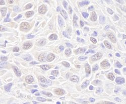 Rad50 Polyclonal Antibody, Bethyl Laboratories 10 &mu;L; Unconjugated:Antibodies,