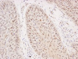 Rad50 Polyclonal Antibody, Bethyl Laboratories 10 &mu;L; Unconjugated:Antibodies,