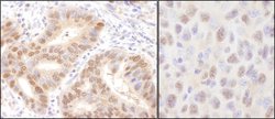 Rad6 Rabbit anti-Human, Mouse, Polyclonal, Bethyl Laboratories 100 &mu;L;