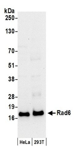 Rad6 Rabbit anti-Human, Mouse, Polyclonal, Bethyl Laboratories 100 &mu;L;