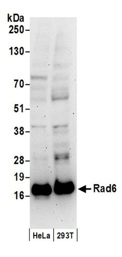Rad6 Polyclonal Antibody, Bethyl Laboratories:Antibodies:Primary Antibodies