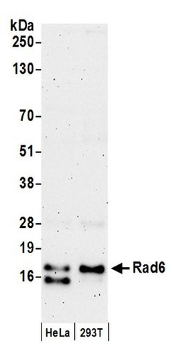 Rad6 Rabbit anti-Human, Polyclonal, Bethyl Laboratories 100 &mu;L; Unconjugated:Antibodies,