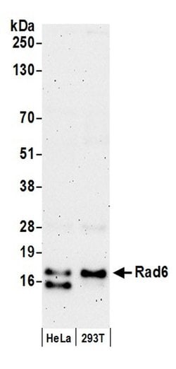 Rad6 Polyclonal Antibody, Bethyl Laboratories 20 &mu;L; Unconjugated:Antibodies,