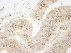 RanBP1 Polyclonal Antibody, Bethyl Laboratories 100 &mu;L; Unconjugated:Antibodies,