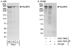 RanBP2 Rabbit anti-Human, Polyclonal, Bethyl Laboratories 100 &mu;L; Unconjugated:Antibodies,