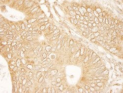 RanGAP1 Polyclonal Antibody, Bethyl Laboratories:Antibodies:Primary Antibodies
