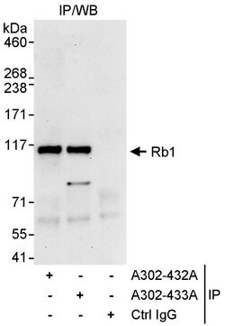 Rb1 Rabbit anti-Human, Polyclonal, Bethyl Laboratories 10 &mu;L; Unconjugated:Antibodies,